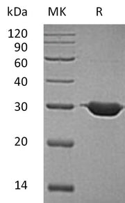 Recombinant Human BDH2 (N-6His)