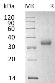Recombinant Human CD2 (C-6His)