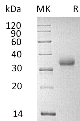 Recombinant Human CD2 (C-6His)