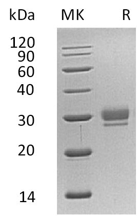 Recombinant Human CTHRC1 (C-6His)