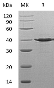 Recombinant Human TSTA3 (C-6His)