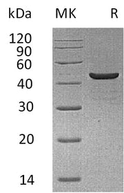 Recombinant Human CKMM (C-6His)