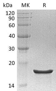 Recombinant Human EDF1 (C-6His)