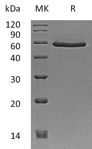 Recombinant Human SMAD3 (N-6His-Flag)