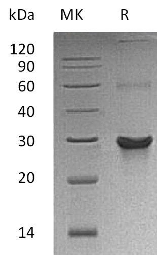 Recombinant Human ATG10 (C-6His, N-T7 tag)