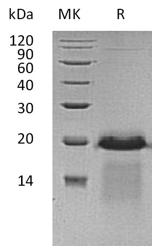 Recombinant Human APBA3 (C-6His)