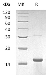Recombinant Human ZNF100 (N-6His)