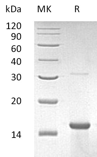 Recombinant Human ZNF100 (N-6His)