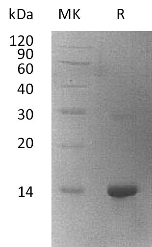 Recombinant Human WBP2 (N-6His)