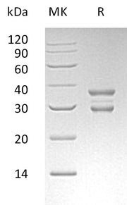 Recombinant Human UBE2J2 (N-GST)