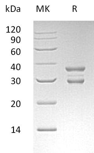 Recombinant Human UBE2J2 (N-GST)