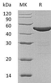Recombinant Human ASS1 (N-6His)