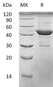 Recombinant Human Beta-Actin (C-6His)