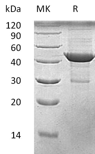 Recombinant Human Beta-Actin (C-6His)