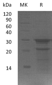 Recombinant Human WIBG (C-6His)