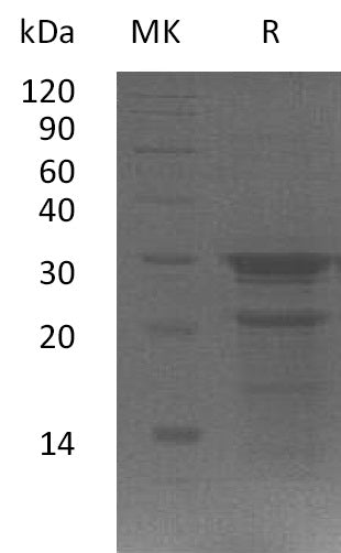 Recombinant Human WIBG (C-6His)