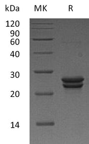 Recombinant Human CDO1 (N-6His)