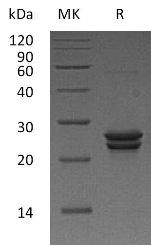 Recombinant Human CDO1 (N-6His)