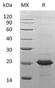 Recombinant Human SOD1 (N-6His)