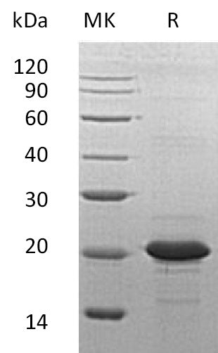 Recombinant Human SOD1 (N-6His)