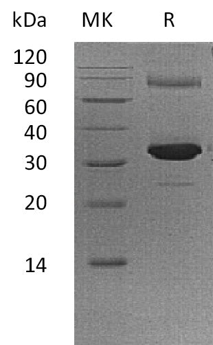 Recombinant Human GNMT (N-6His)