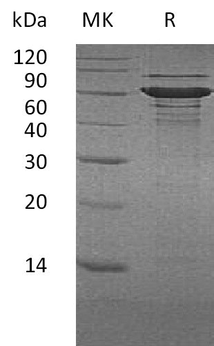 Recombinant Human BLNK (C-6His)