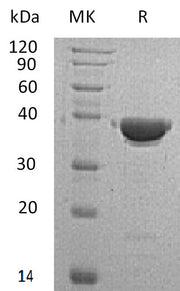 Recombinant Human AKR1C4 (N-6His)