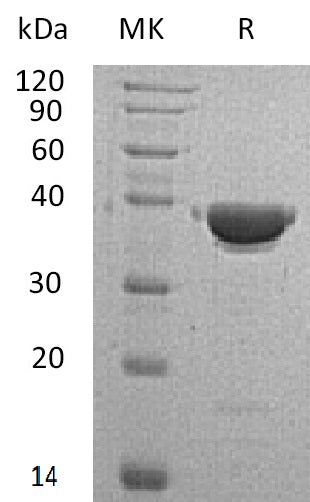 Recombinant Human AKR1C4 (N-6His)
