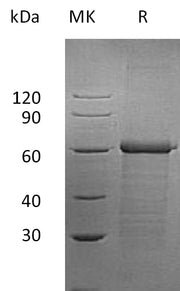 Recombinant Human UBAP1 (C-6His)
