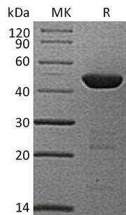 Recombinant Human 4HPPD (N-6His)