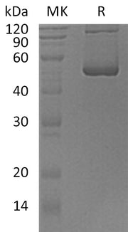 Recombinant Human SCLY (N-6His)