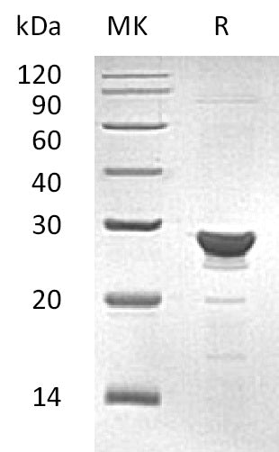 Recombinant Human GSTZ1 (C-6His)