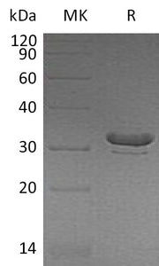 Recombinant Human BIN2 (N-6His)