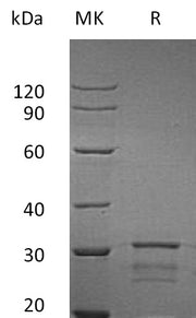 Recombinant Human Isomerase2 (N-6His)