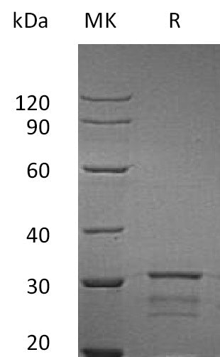 Recombinant Human Isomerase2 (N-6His)