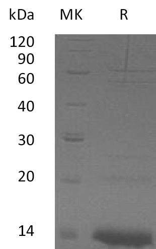 Recombinant Human ZNF75A (N-6His)