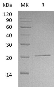 Recombinant Human NIP7 (N-6His)