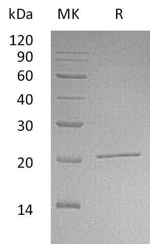 Recombinant Human NIP7 (N-6His)