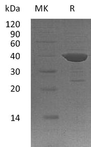 Recombinant Human ADPRH (N-6His)