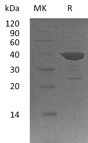 Recombinant Human ADPRH (N-6His)