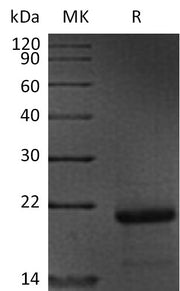 Recombinant Human WBP1 (N-6His)