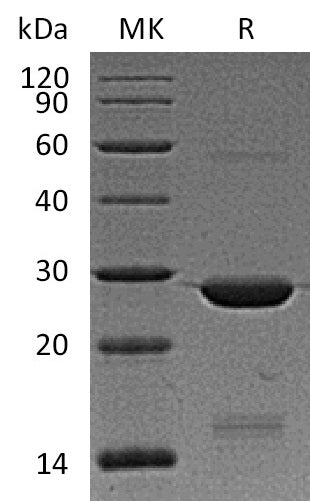 Recombinant Human BAG2 (N-6His)