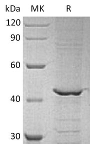 Recombinant Human GALK1 (C-6His)