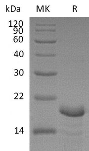 Recombinant Human CNB1 (N-6His)