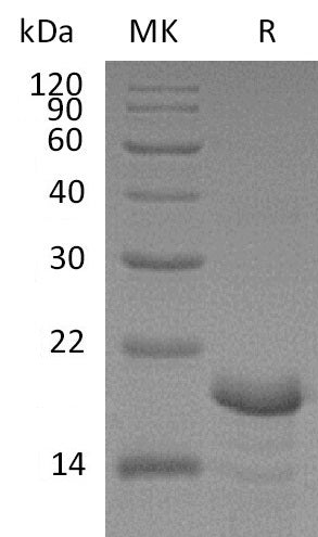 Recombinant Human CNB1 (N-6His)