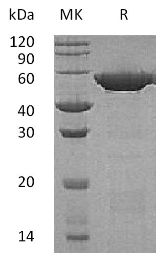Recombinant Human GSH-S (C-6His)