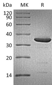 Recombinant Human ARG2 (C-6His)