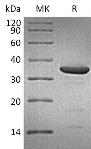 Recombinant Human ARG2 (C-6His)