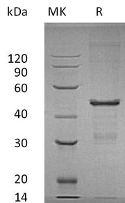 Recombinant Human MBIPP (N-6His)