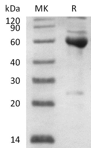 Recombinant Human Serpin B6 (N-Trx-6His)